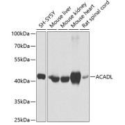 Western blot analysis of various lysates using ACADL Antibody at 1/1000 dilution. Secondary antibody: HRP-conjugated Goat anti-Rabbit IgG (H+L) at 1/10000 dilution. Lysates/proteins: 25 µg per lane. Blocking buffer: 3% nonfat dry milk in TBST. Exposure time: 1s.