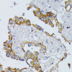 Acyl-CoA Dehydrogenase, Long Chain (ACADL) Antibody