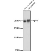 Western blot analysis of various lysates using ApoB Antibody at 1/1000 dilution. Secondary antibody: HRP-conjugated Goat anti-Rabbit IgG (H+L) at 1/10000 dilution. Lysates / proteins: 25 µg per lane. Blocking buffer: 3 % nonfat dry milk in TBST. Detection: ECL Basic Kit (RM00020). Exposure time: 1s.