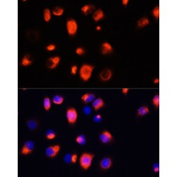 Heme Oxygenase 1 (HMOX1) Antibody