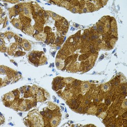 Cholesteryl Ester Transfer Protein (CETP) Antibody