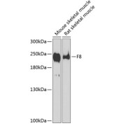 Western blot analysis of various lysates using F8 Antibody at 1/1000 dilution. Secondary antibody: HRP-conjugated Goat anti-Rabbit IgG (H+L) at 1/10000 dilution. Lysates/proteins: 25 µg per lane. Blocking buffer: 3% nonfat dry milk in TBST. Exposure time: 90s.