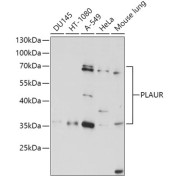 Western blot analysis of various lysates using PLAUR Antibody at 1/1000 dilution. Secondary antibody: HRP-conjugated Goat anti-Rabbit IgG (H+L) at 1/10000 dilution. Lysates/proteins: 25 µg per lane. Blocking buffer: 3% nonfat dry milk in TBST. Exposure time: 15s.
