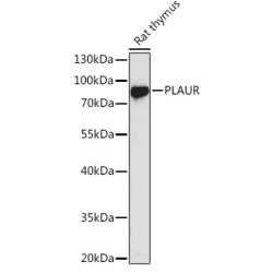Urokinase Plasminogen Activator Surface Receptor / uPAR / CD87 (PLAUR) Antibody