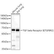 Western blot analysis of various lysates using TGF beta Receptor II (TGFBR2) Antibody at 1/2000 dilution. Secondary antibody: HRP-conjugated Goat anti-Rabbit IgG (H+L) at 1/10000 dilution. Lysates / proteins: 25 µg per lane. Blocking buffer: 3 % nonfat dry milk in TBST. Detection: ECL Basic Kit (RM00020). Exposure time: 5s.