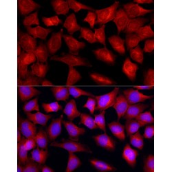 Transforming Growth Factor Beta Receptor 2 (TGFBR2) Antibody