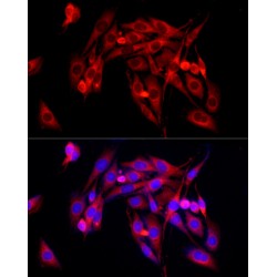 Transforming Growth Factor Beta Receptor 2 (TGFBR2) Antibody