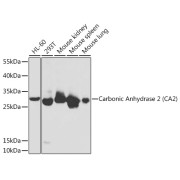 Western blot analysis of various lysates using Carbonic Anhydrase 2 (CA2) Antibody at 1/1000 dilution. Secondary antibody: HRP-conjugated Goat anti-Rabbit IgG (H+L) at 1/10000 dilution. Lysates/proteins: 25 µg per lane. Blocking buffer: 3% nonfat dry milk in TBST.