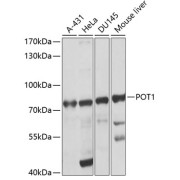 Western blot analysis of various lysates using POT1 Antibody at 1/1000 dilution. Secondary antibody: HRP-conjugated Goat anti-Rabbit IgG (H+L) at 1/10000 dilution. Lysates/proteins: 25 µg per lane. Blocking buffer: 3% nonfat dry milk in TBST. Exposure time: 30s.