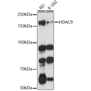 Western blot analysis of various lysates using HDAC9 Antibody at 1/1000 dilution. Secondary antibody: HRP-conjugated Goat anti-Rabbit IgG (H+L) at 1/10000 dilution. Lysates/proteins: 25 µg per lane. Blocking buffer: 3% nonfat dry milk in TBST. Exposure time: 90s.