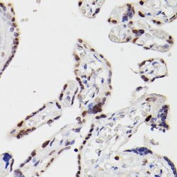 Histone Deacetylase 9 (HDAC9) Antibody