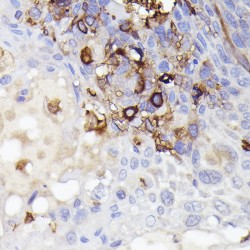 Allograft Inflammatory Factor 1 (AIF1) Antibody