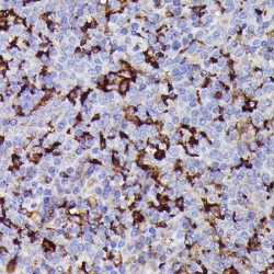 Allograft Inflammatory Factor 1 (AIF1) Antibody