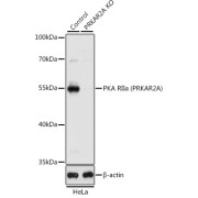 Western blot analysis of lysates from wild type (WT) and PKA RIIα (PRKAR2A)/PKR2 knockout (KO) HeLa cells, using [KO Validated] PKA RIIα (PRKAR2A) Antibody at 1/1000 dilution. Secondary antibody: HRP-conjugated Goat anti-Rabbit IgG (H+L) at 1/10000 dilution. Lysates/proteins: 25 µg per lane. Blocking buffer: 3% nonfat dry milk in TBST. Exposure time: 5s.