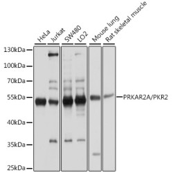 Protein Kinase cAMP-Dependent Type II Regulatory Subunit Alpha (PRKAR2A) Antibody