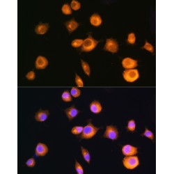 Protein Kinase cAMP-Dependent Type II Regulatory Subunit Alpha (PRKAR2A) Antibody