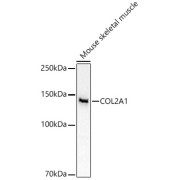 Western blot analysis of lysates from Mouse skeletal muscle, using COL2A1 Antibody at 1/1000 dilution. Secondary antibody: HRP-conjugated Goat anti-Rabbit IgG (H+L) at 1/10000 dilution. Lysates/proteins: 25 µg per lane. Blocking buffer: 3% nonfat dry milk in TBST. Exposure time: 10s.