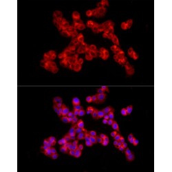 Collagen Type II Alpha 1 (COL2A1) Antibody