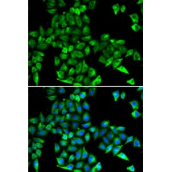 Cystatin C (CST3) Antibody