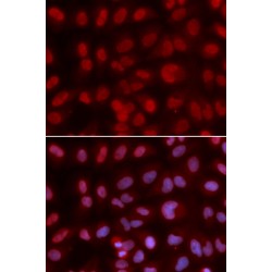 SIN3 Transcription Regulator Family Member A (SIN3A) Antibody