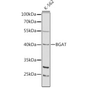 Western blot analysis of lysates from K-562 cells, using BGAT Antibody at 1/1000 dilution. Secondary antibody: HRP-conjugated Goat anti-Rabbit IgG (H+L) at 1/10000 dilution. Lysates/proteins: 25 µg per lane. Blocking buffer: 3% nonfat dry milk in TBST.