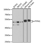 Western blot analysis of various lysates using PTPN1 Antibody at 1/1000 dilution. Secondary antibody: HRP-conjugated Goat anti-Rabbit IgG (H+L) at 1/10000 dilution. Lysates/proteins: 25 µg per lane. Blocking buffer: 3% nonfat dry milk in TBST. Exposure time: 90s.