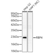 Western blot analysis of various lysates, using RBP4 Antibody at 1/300 dilution. Secondary antibody: HRP-conjugated Goat anti-Rabbit IgG (H+L) at 1/10000 dilution. Lysates/proteins: 25 µg per lane. Blocking buffer: 3% nonfat dry milk in TBST. Negative control (NC) :HAP1 Exposure time: 30s.