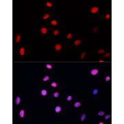 Immunofluorescence analysis of C6 cells using ERCC5 Antibody at dilution of 1/100 (40x lens). Secondary antibody: Cy3-conjugated Goat anti-Rabbit IgG (H+L) at 1/500 dilution. Blue: DAPI for nuclear staining.