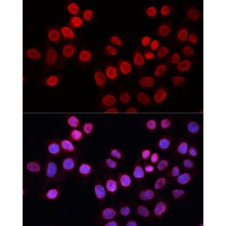 DNA Repair Protein Complementing XP-G Cells (ERCC5) Antibody