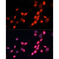 DNA Repair Protein Complementing XP-G Cells (ERCC5) Antibody