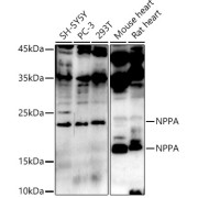 Western blot analysis of various lysates using NPPA Antibody at 1/1000 dilution. Secondary antibody: HRP-conjugated Goat anti-Rabbit IgG (H+L) at 1/10000 dilution. Lysates/proteins: 25 µg per lane. Blocking buffer: 3% nonfat dry milk in TBST. Exposure time: 90s.