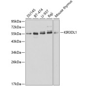 Western blot analysis of various lysates using KIR3DL1 Antibody at 1/1000 dilution. Secondary antibody: HRP-conjugated Goat anti-Rabbit IgG (H+L) at 1/10000 dilution. Lysates/proteins: 25 µg per lane. Blocking buffer: 3% nonfat dry milk in TBST.