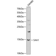 Western blot analysis of lysates from SW480 cells, using SAA1 Antibody at 1/1000 dilution. Secondary antibody: HRP-conjugated Goat anti-Rabbit IgG (H+L) at 1/10000 dilution. Lysates/proteins: 25 µg per lane. Blocking buffer: 3% nonfat dry milk in TBST.