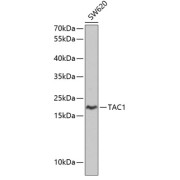 Western blot analysis of lysates from SW620 cells, using TAC1 Antibody at 1/1000 dilution. Secondary antibody: HRP-conjugated Goat anti-Rabbit IgG (H+L) at 1/10000 dilution. Lysates/proteins: 25 µg per lane. Blocking buffer: 3% nonfat dry milk in TBST. Exposure time: 90s.