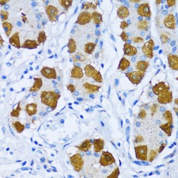 Polymerase DNA Directed Beta (POLB) Antibody