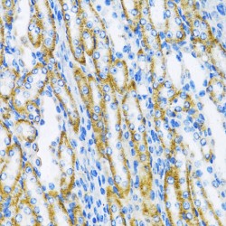 Polymerase DNA Directed Beta (POLB) Antibody