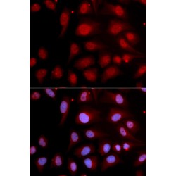 Polymerase DNA Directed Beta (POLB) Antibody