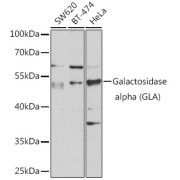 Western blot analysis of various lysates using Galactosidase alpha (GLA) Antibody at 1/1000 dilution. Secondary antibody: HRP-conjugated Goat anti-Rabbit IgG (H+L) at 1/10000 dilution. Lysates/proteins: 25 µg per lane. Blocking buffer: 3% nonfat dry milk in TBST. Exposure time: 30s.