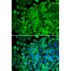 Galactosidase Alpha (GLA) Antibody