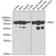 Western blot analysis of various lysates using ARSA Antibody at 1/1000 dilution. Secondary antibody: HRP-conjugated Goat anti-Rabbit IgG (H+L) at 1/10000 dilution. Lysates/proteins: 25 µg per lane. Blocking buffer: 3% nonfat dry milk in TBST.