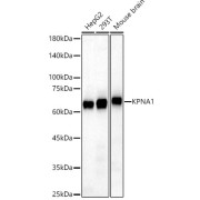 Western blot analysis of various lysates, using KPNA1 Antibody at 1/1000 dilution. Secondary antibody: HRP-conjugated Goat anti-Rabbit IgG (H+L) at 1/10000 dilution. Lysates/proteins: 25 µg per lane. Blocking buffer: 3% nonfat dry milk in TBST. Exposure time: 10s.