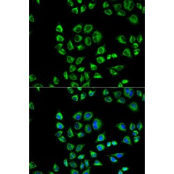 Antigen-Presenting Glycoprotein CD1d (CD1D) Antibody