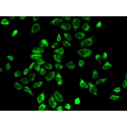 3 Beta-Hydroxysteroid Dehydrogenase/Delta 5->4-Isomerase Type 2 (HSD3B2) Antibody