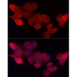 Leukocyte Surface Antigen CD47 (CD47) Antibody