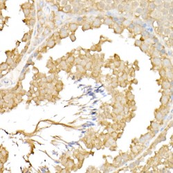 X-Linked Retinitis Pigmentosa GTPase Regulator (RPGR) Antibody