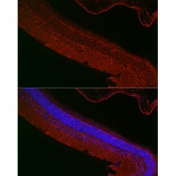 X-Linked Retinitis Pigmentosa GTPase Regulator (RPGR) Antibody