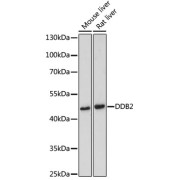 Western blot analysis of various lysates using DDB2 Antibody at 1/500 dilution. Secondary antibody: HRP-conjugated Goat anti-Rabbit IgG (H+L) at 1/10000 dilution. Lysates/proteins: 25 µg per lane. Blocking buffer: 3% nonfat dry milk in TBST. Exposure time: 90s.