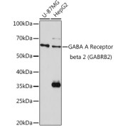 Western blot analysis of various lysates using GABA A Receptor beta 2 (GABA A Receptor beta 2 (GABRB2)) Antibody at 1/1000 dilution. Secondary antibody: HRP-conjugated Goat anti-Rabbit IgG (H+L) at 1/10000 dilution. Lysates/proteins: 25 µg per lane. Blocking buffer: 3% nonfat dry milk in TBST. Exposure time: 180s.