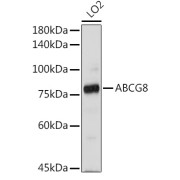 Western blot analysis of various lysates using ABCG8 Antibody at 1/1000 dilution. Secondary antibody: HRP-conjugated Goat anti-Rabbit IgG (H+L) at 1/10000 dilution. Lysates / proteins: 25 µg per lane. Blocking buffer: 3 % nonfat dry milk in TBST. Detection: ECL Basic Kit (RM00020). Exposure time: 180s.