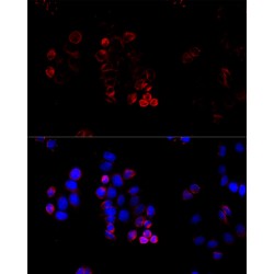 ATP Binding Cassette Subfamily G Member 8 (ABCG8) Antibody